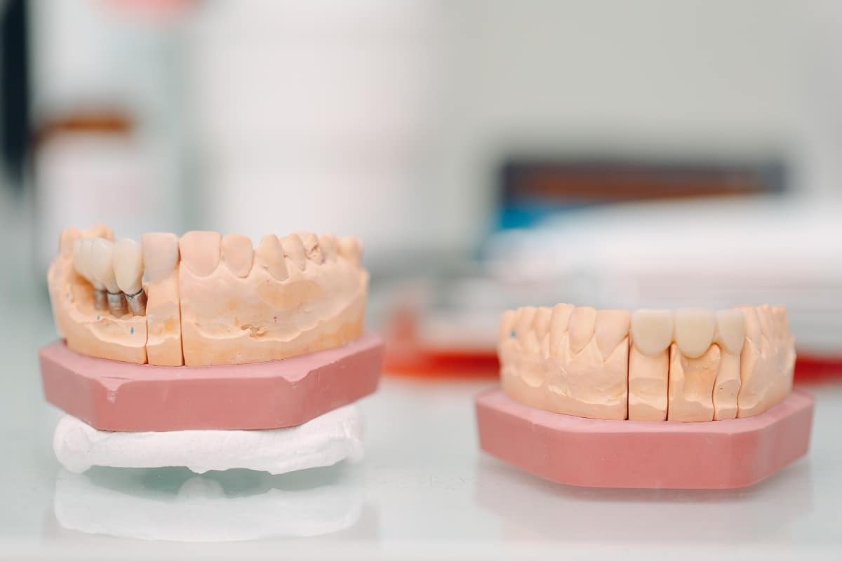 implant tedavisi