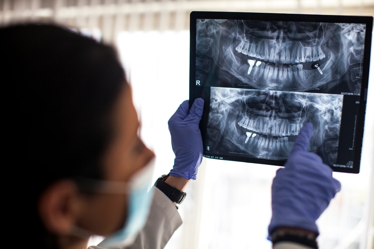 implant tedavisi