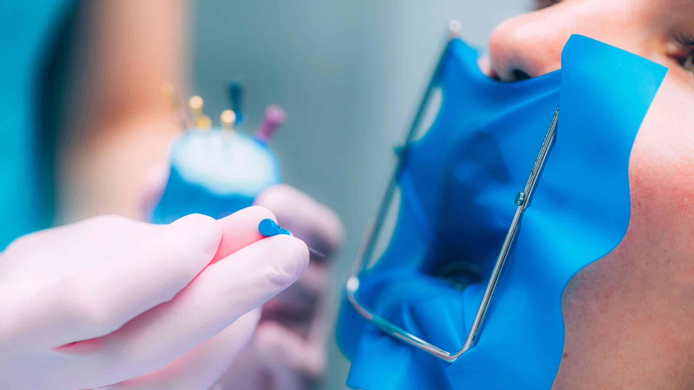 endodonti tedavisi uygulaması