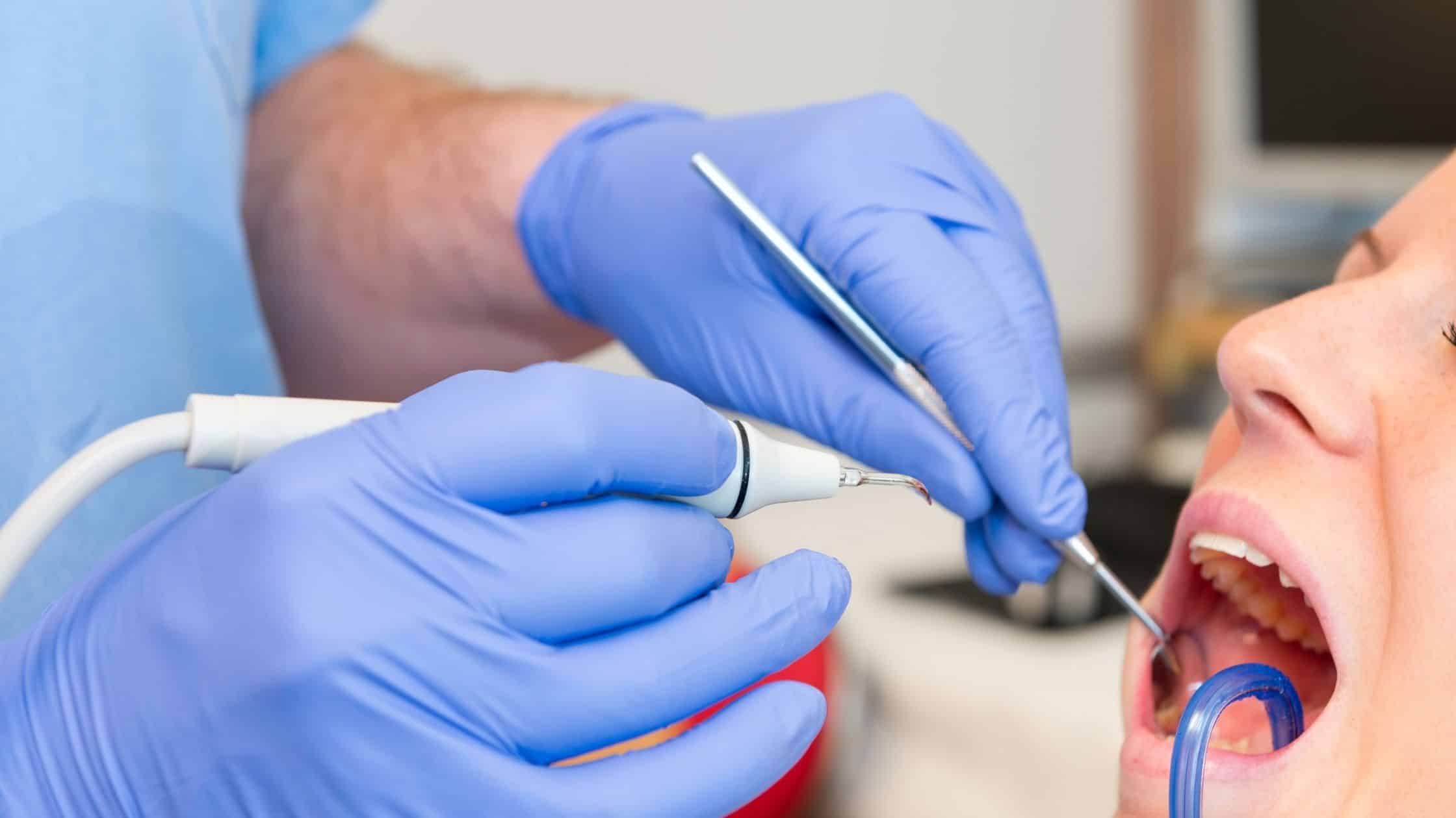 diş taşı temizliği yapan bir doktor ve hastası