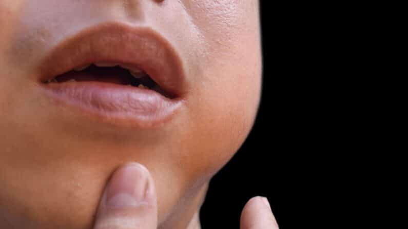 başarısız implant belirtileri